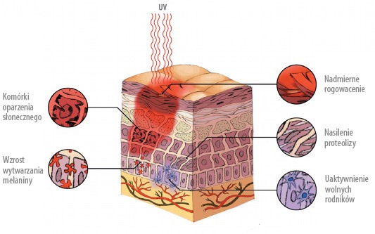 Przekrój warstw skóry. Wolne rodniki - skutek promieniowania UV.