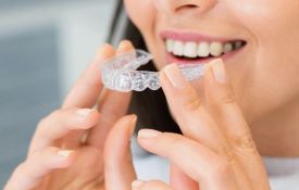Nakładki na zęby - czy aparat nakładkowy naprawdę działa?