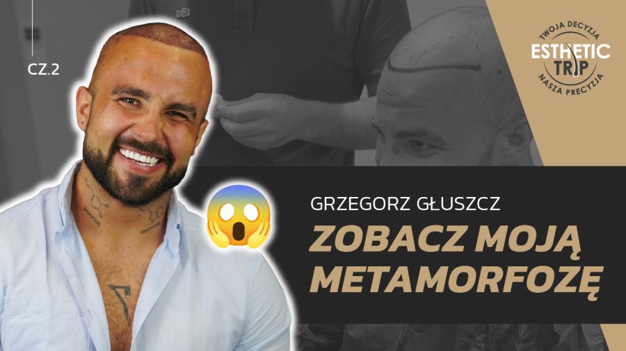 metamorfoza Grzegorza Głuszcza