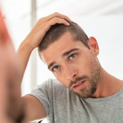 Łysiejesz? Sprawdź, czy dermapen na głowę pomoże