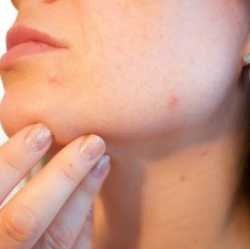 Twoja skóra też potrzebuje kontroli – kiedy umówić się do dermatologa?