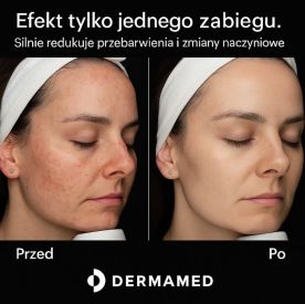 Ewolucja medycyny estetycznej - zabiegi stymulujące procesy naprawcze w skórze