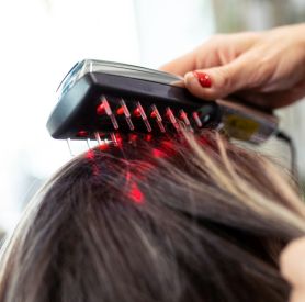 Jak działa laser na porost włosów i czego można się spodziewać?