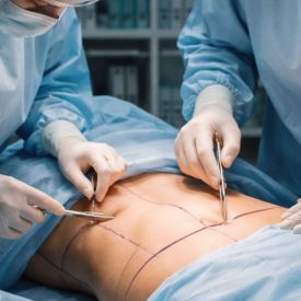 Ile kosztuje płaski brzuch - plastyka brzucha cena