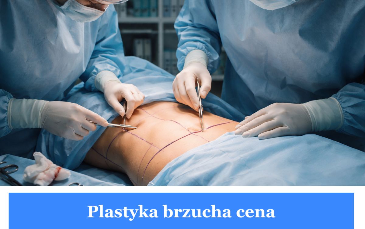 plastyka brzucha