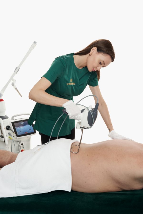 liposukcja laserowa