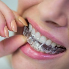 Ortodonta Opole – jak wybrać specjalistę i czym różni się leczenie Invisalign od tradycyjnego aparatu