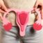 PCOS – co to jest, jakie są objawy i&nbsp;jak zdiagnozować zespół policystycznych jajników?